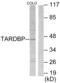 T-box transcription factor TBX1 antibody, abx013292, Abbexa, Western Blot image 