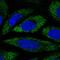 Progressive ankylosis protein homolog antibody, HPA068104, Atlas Antibodies, Immunofluorescence image 