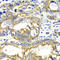 Adenylate Kinase 2 antibody, A6519, ABclonal Technology, Immunohistochemistry paraffin image 