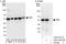 Proteasome 26S Subunit, ATPase 3 antibody, A303-537A, Bethyl Labs, Western Blot image 