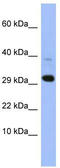 Mitochondrial Ribosomal Protein L47 antibody, TA344614, Origene, Western Blot image 