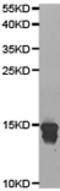 Epididymal Peptidase Inhibitor antibody, TA322256, Origene, Western Blot image 