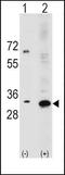 Ribosomal Protein S6 antibody, PA5-11818, Invitrogen Antibodies, Western Blot image 