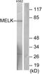 Maternal Embryonic Leucine Zipper Kinase antibody, LS-C119044, Lifespan Biosciences, Western Blot image 