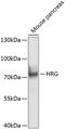 Histidine-rich glycoprotein antibody, GTX64492, GeneTex, Western Blot image 