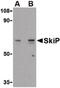 SNW domain-containing protein 1 antibody, LS-B590, Lifespan Biosciences, Western Blot image 