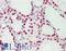 SF3b155 antibody, LS-B12402, Lifespan Biosciences, Immunohistochemistry paraffin image 