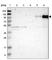 Integrin Subunit Beta 2 antibody, HPA016894, Atlas Antibodies, Western Blot image 