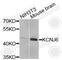 Potassium Voltage-Gated Channel Subfamily J Member 6 antibody, A9935, ABclonal Technology, Western Blot image 