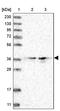 ELOVL Fatty Acid Elongase 7 antibody, PA5-57615, Invitrogen Antibodies, Western Blot image 