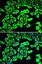 Ribosomal Protein Lateral Stalk Subunit P2 antibody, STJ29054, St John