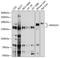 Mannosidase Alpha Class 2A Member 1 antibody, A09184, Boster Biological Technology, Western Blot image 