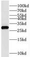 Syntaxin Binding Protein 6 antibody, FNab08365, FineTest, Western Blot image 