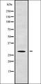 PAX3 And PAX7 Binding Protein 1 antibody, orb338325, Biorbyt, Western Blot image 