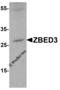Zinc Finger BED-Type Containing 3 antibody, 5123, ProSci, Western Blot image 