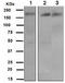 Insulin receptor substrate 2 antibody, TA307786, Origene, Western Blot image 