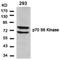 Ribosomal Protein S6 Kinase B1 antibody, AP02773PU-S, Origene, Western Blot image 