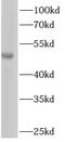 Rho GTPase Activating Protein 1 antibody, FNab00545, FineTest, Western Blot image 