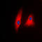Phospholipase C Gamma 1 antibody, LS-C352671, Lifespan Biosciences, Immunofluorescence image 