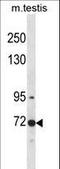 CDC Like Kinase 3 antibody, LS-C164348, Lifespan Biosciences, Western Blot image 