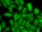 Potassium channel subfamily T member 1 antibody, SMC-323D-A655, StressMarq, Immunofluorescence image 