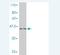 Histone chaperone ASF1B antibody, H00055723-M01, Novus Biologicals, Western Blot image 