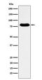 GTP Binding Protein 4 antibody, M10450-1, Boster Biological Technology, Western Blot image 