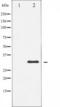 Nucleophosmin 1 antibody, TA325746, Origene, Western Blot image 