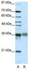 T Cell Leukemia Homeobox 2 antibody, TA345195, Origene, Western Blot image 