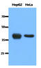 Sterol O-acyltransferase 1 antibody, AM50027PU-N, Origene, Western Blot image 