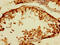 Tryptase Beta 2 (Gene/Pseudogene) antibody, A63704-100, Epigentek, Immunohistochemistry paraffin image 