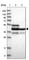 DNA Fragmentation Factor Subunit Alpha antibody, HPA019938, Atlas Antibodies, Western Blot image 