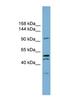 Anoctamin-6 antibody, NBP1-59655, Novus Biologicals, Western Blot image 