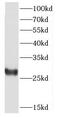 Casein kinase II subunit beta antibody, FNab01281, FineTest, Western Blot image 