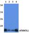 Ataxin 7 Like 1 antibody, A12910-1, Boster Biological Technology, Western Blot image 