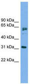 Microtubule Interacting And Trafficking Domain Containing 1 antibody, TA340313, Origene, Western Blot image 