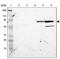 Zinc Finger Protein 234 antibody, PA5-51621, Invitrogen Antibodies, Western Blot image 