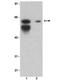 p68 antibody, LS-B8719, Lifespan Biosciences, Western Blot image 