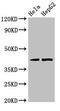 cAMP-dependent protein kinase catalytic subunit gamma antibody, CSB-PA018690LA01HU, Cusabio, Western Blot image 