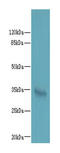 LysM Domain Containing 3 antibody, A65786-100, Epigentek, Western Blot image 
