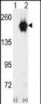 GAK Protein antibody, PA5-15321, Invitrogen Antibodies, Western Blot image 