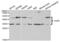 VAMP Associated Protein B And C antibody, abx004104, Abbexa, Western Blot image 