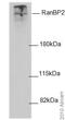 RBP2 antibody, ab64276, Abcam, Western Blot image 