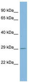 26S proteasome non-ATPase regulatory subunit 10 antibody, TA342177, Origene, Western Blot image 