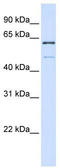 Methyltransferase-like protein 16 antibody, TA342472, Origene, Western Blot image 