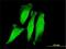 RING finger protein 11 antibody, H00026994-M01, Novus Biologicals, Immunocytochemistry image 