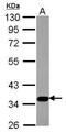 AST antibody, GTX115822, GeneTex, Western Blot image 