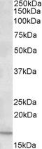 C-X-C motif chemokine 2 antibody, STJ71916, St John