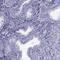 Arachidonate 15-Lipoxygenase Type B antibody, HPA010562, Atlas Antibodies, Immunohistochemistry paraffin image 