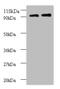 Ribosomal Protein S12 antibody, A52720-100, Epigentek, Western Blot image 